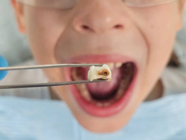Best Pediatric Emergency Dentist in Quincy, MA
