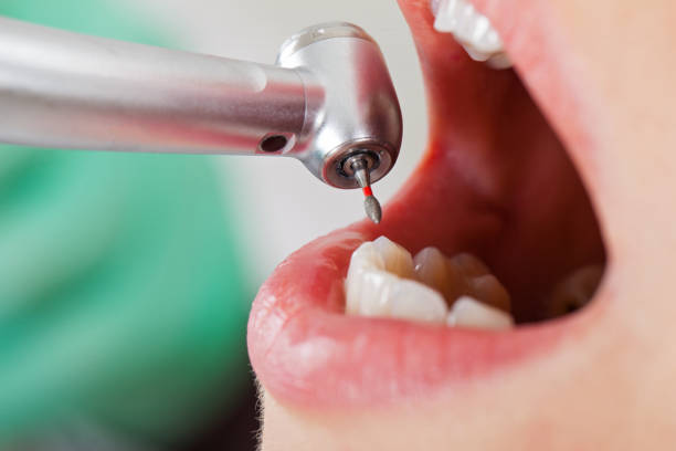 Best Walk-In Emergency Dentist in Quincy, MA